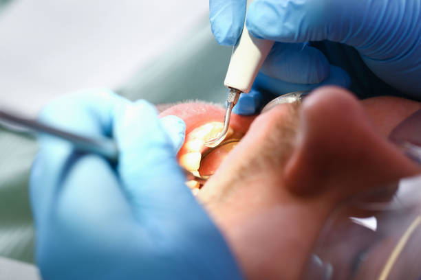 Best Broken or Cracked Tooth Emergency Dentist in West Kennebunk, ME