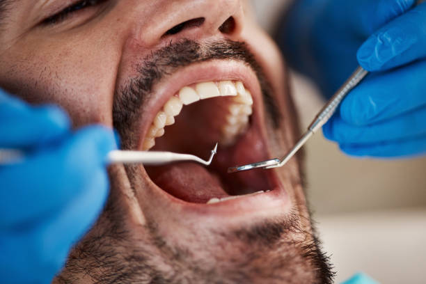 Best Emergency Dentist for Knocked-Out Tooth in West Kennebunk, ME