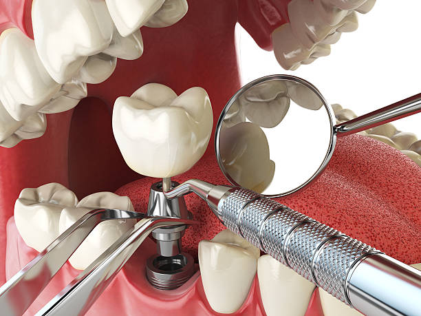Best Urgent Dental Care for Toothache in West Kennebunk, ME