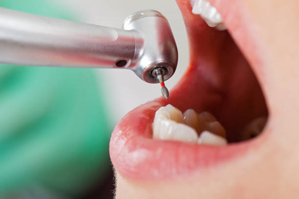 Best Emergency Dentist for Lost Fillings or Crowns in West Kennebunk, ME